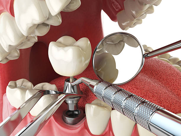 Best Emergency Dental Surgery in Minonk, IL