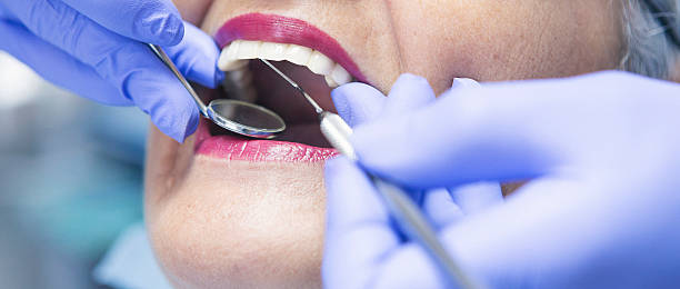 Best Emergency Tooth Extraction in Minonk, IL